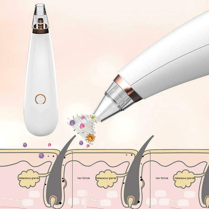 [Australia] - Pore Cleansing Blackhead Vacuum [Upgraded for 2020] 