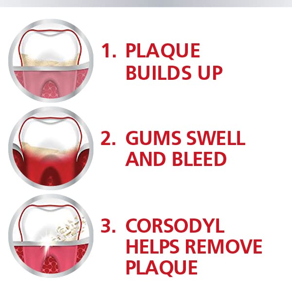 [Australia] - Corsodyl 0.2% Gum Disease & Bleeding Treatment Mouthwash, Alcohol Free, Mint Flavour, 300 ml 0.2% Mouthwash 