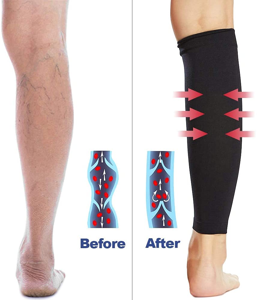 Beister 1 Pair Compression Calf Sleeves (20-30mmHg), Perfect Calf