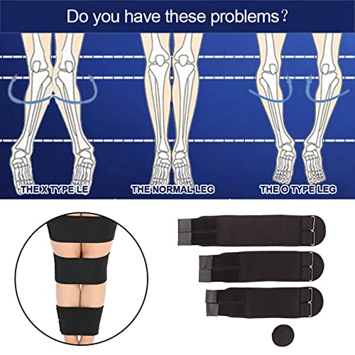 [Australia] - Posture Corrector X/O Shape Leg Correction Belt Professional Knee Valgus Straighten Belt Fixer for Adult & Kids, Recovery Beauty Straightening Leg(L) 