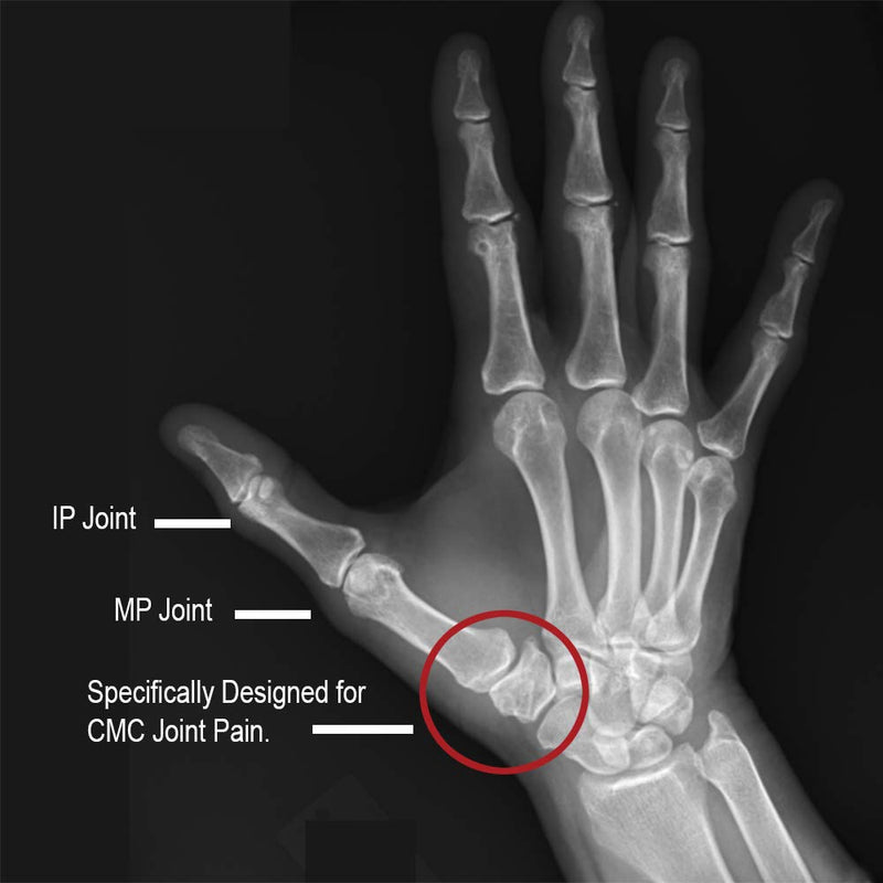 [Australia] - Comfort Cool Thumb CMC Restriction Splint, Left Medium Plus 7-7/8" to 8-1/4" Left Medium 7-1/4” to 8-1/4” 