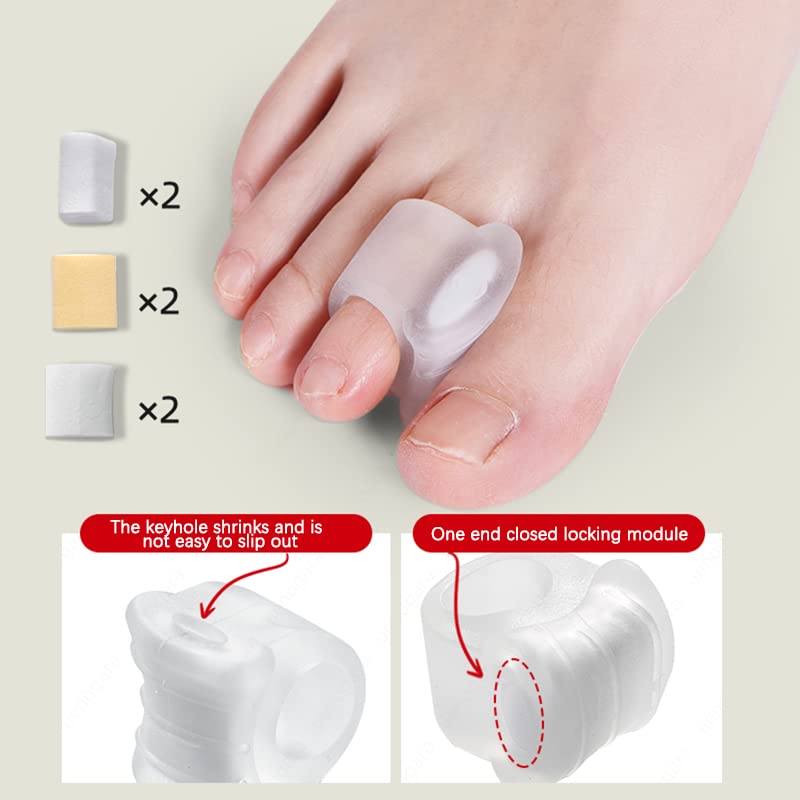 [Australia] - Toe Separators Gel- Big Toe Spacers - Corrector and Spacer- Bunion Corrector and Bunion Relief - Pads for Overlapping,Yoga 