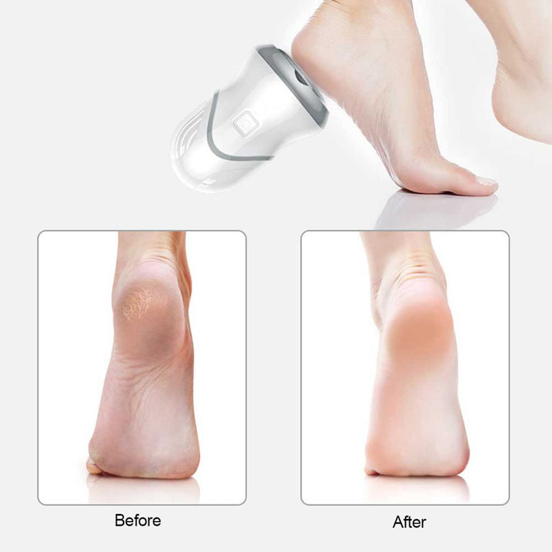 [Australia] - Electric Foot Grinder, Adjustable Foot File Foot Dead Skin Remover, Exfoliating Bortev Electric Foot Grinder For Foot Rasps Pedicure Foot Care Tools 