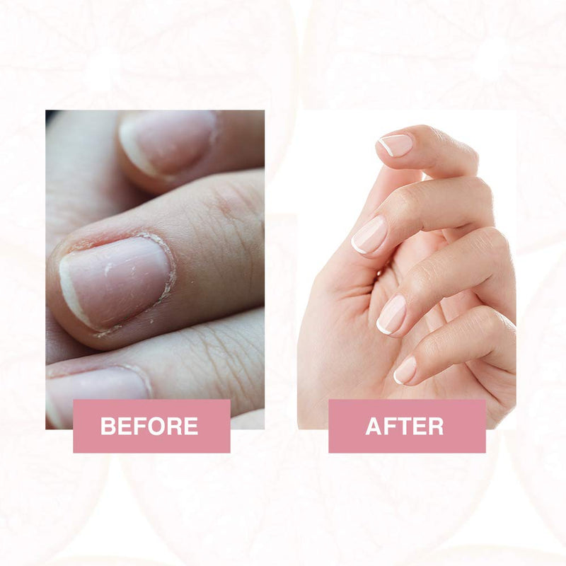 [Australia] - Gena Mani Spa Liquid Hand Soak, Softens, Moisturizes Hands, Nails, and Cuticles For Great Manicure Treatment 8 Oz 
