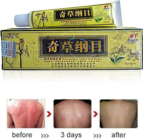 [Australia] - 2pcs Chinese Herbal Eczema, Psoriasis Creams Dermatitis and Eczema Pruritus Psoriasis CEZUBEM Ointment 