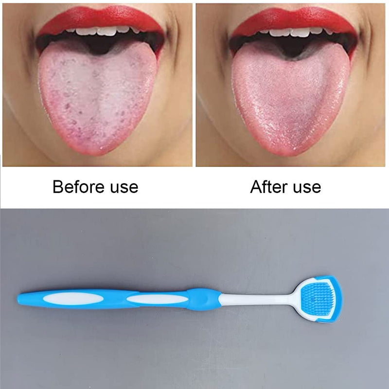 [Australia] - 2 Pcs Tongue Scrapers Portable Tongue Brushes Non Slip Tongue Cleaners for Fresh Breath Dental Eliminate Bad Breath 