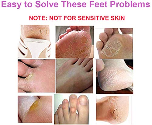 [Australia] - BOMPOW Foot Peel Mask, Exfoliating Socks Foot Mask, Peel Off Dry Dead Cracked Hard Skin in 3-7 Days, Lavender Scented Exfoliating Foot Socks, 2 Pairs Lavender Scent 