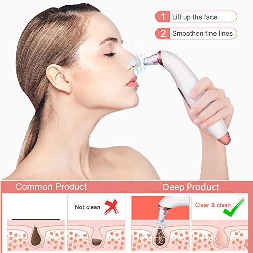 [Australia] - Electric facial Blackhead Remover and 6 suction cup kits, USB rechargeable Blackhead Remover, upgraded electric facial Blackhead Remover with 3 adjustable suction cups for deep facial cleaning, Rose Gold 