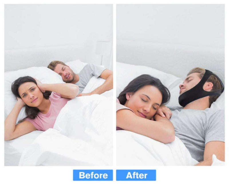 [Australia] - Anti Snoring Chin Strap Stop Snoring Aids Breathable Stop Snore Chin Strap Snoring Solution Snore Stopper Adjustable Anti Snoring Belt Stop Snoring Device for Men, Women, CPAP Users, Mouth Breather Black 