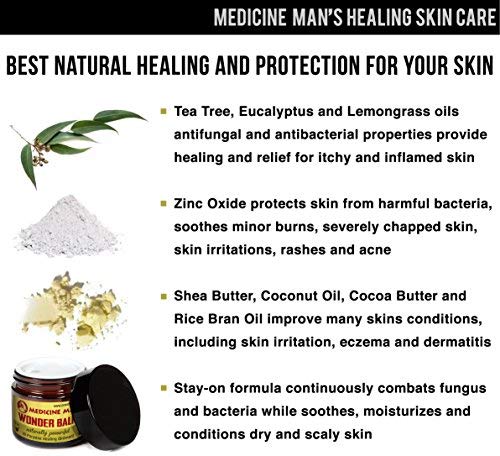 [Australia] - Medicine Man’s Wonder Balm - All Purpose Healing Ointment 2 oz - Natural Formula for Itchy, Scaly or Cracked Skin - Good as Fungus Infection Treatment, Skin Rash Cream, Psoriasis, Athletes Foot Care 