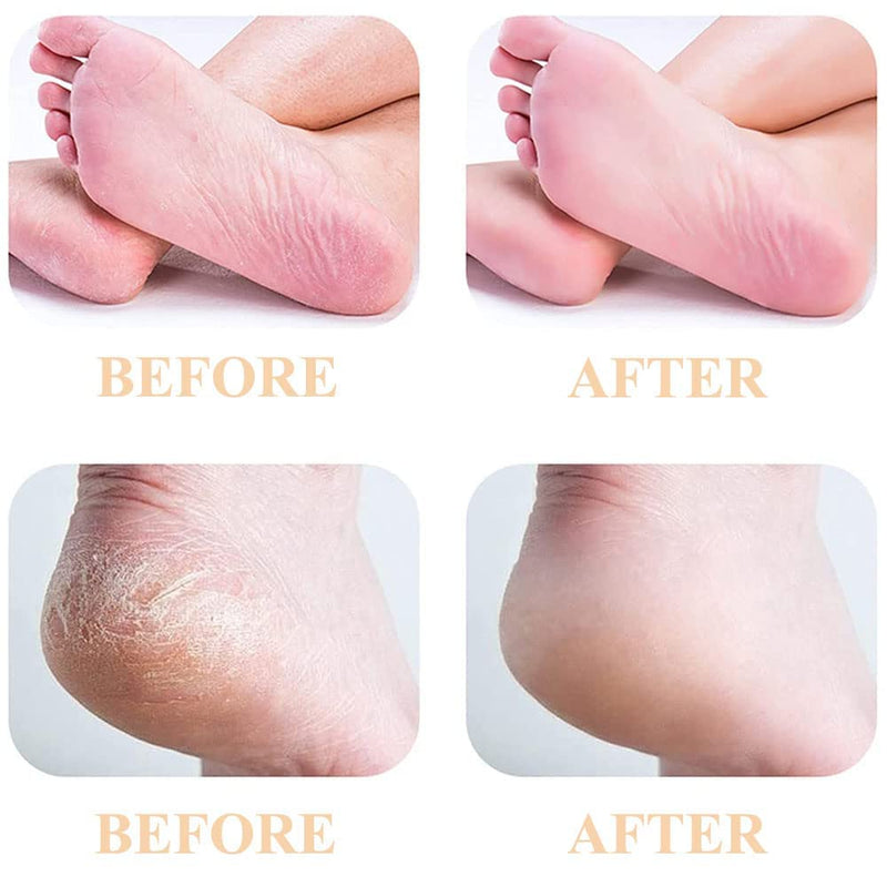 [Australia] - P4L 6 Pcs Pedicures Replacement Heads for Flawless Pedi Electric Tool Foot File,Pedi Replacement Roller Head fit Finishing Touch Flawless Pedi as seen on TV (3 Coarse & 3 Fine), Grey, 6 Pack 6 Pack/P4L 
