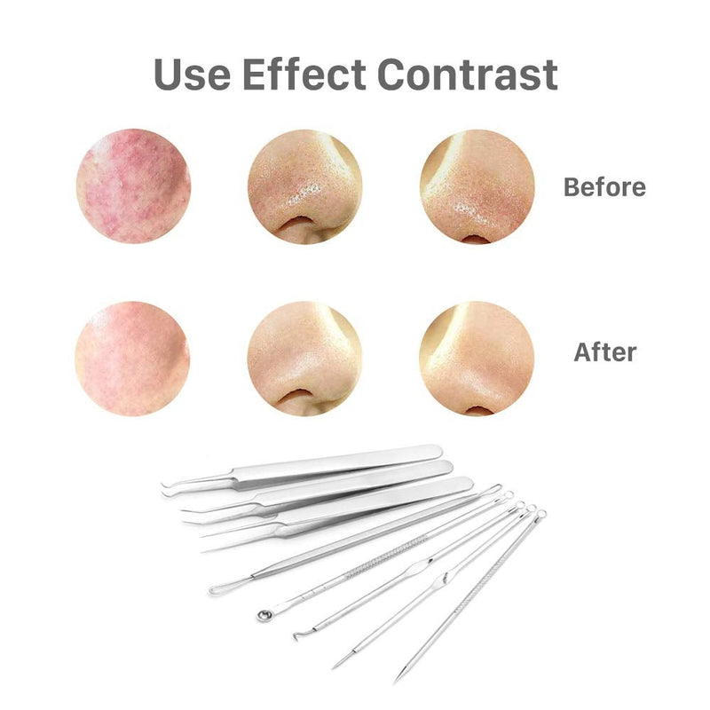 [Australia] - Pinkiou Blackhead Removers Comedone Pimple Removal Extractors Acne Blemish Needles Tool Kit Nose Face Skincare, 8-in-1 with Metal Case 
