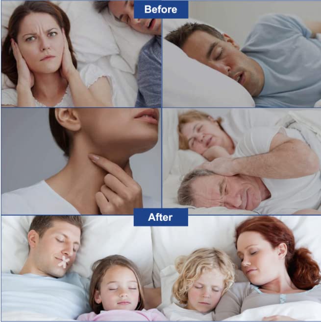 [Australia] - 120 Sleep Stickers Anti-snoring Lip Stickers Reduce Mouth Breathing Breathe Through Nose Improve snoring Improve Sleep Quality 