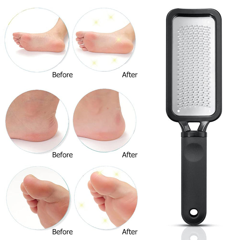 [Australia] - Foot Rasp Hard Skin Remover, Dead Skin Remover for Feet, Pedicure Foot File Make Foot Beauty Extra Smooth, Foot Scrub Foot Exfoliator for Corn Removal, Feet Care Callous Removers for Feet (1 Black) 1 Black 
