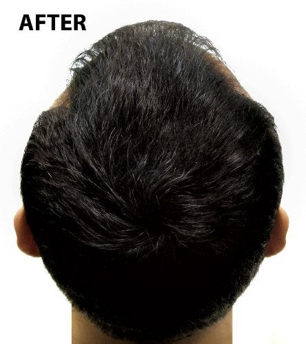 [Australia] - Super Million Hair - 1 x 25g Hair Building Fibres - No.7 Wheat Blonde 