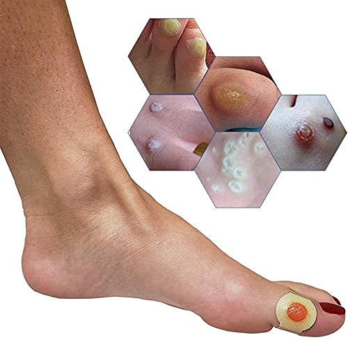 [Australia] - Corn Removal Pads,Wart Remover Pads,Corn Removal Plaster,Foot Corn Remover Patch,Relief Corn Pain and Foot Care,Remove Corns,Calluses,Warts 