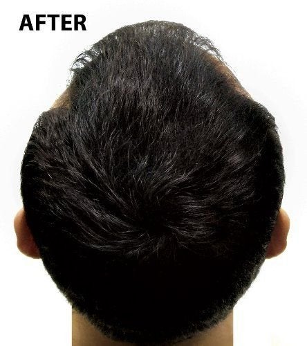 [Australia] - Super Million Hair - 15g Hair Fibres - No.67 Natural Blonde 