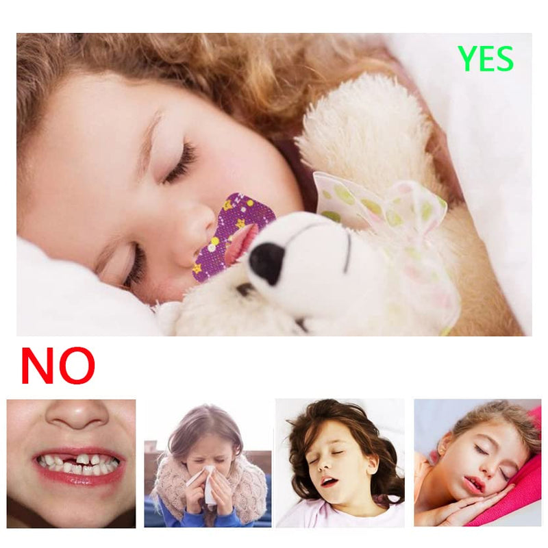 [Australia] - Mouth Tape for Sleeping,New Sleep Strips 60pcs, Stop Snoring Mouth Tape for Better Nose Breathing Sleep Aids Mouth Sleep Strips for Snoring Reduction. (Child) Children 