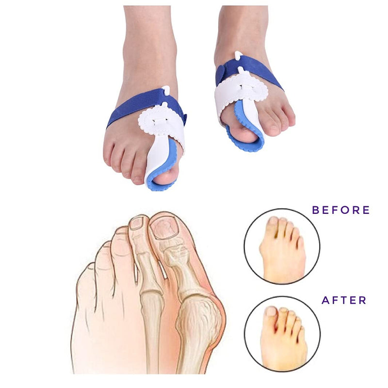 [Australia] - OYSTERBOY Adjustable Strap Hinged Orthopedic Bunion Splint Corrector with Soft Padding, Big Toe Separator Pain Relief, Non-Surgical Hallux Valgus Correction, Hammer Toe Straightener, Day Night Support 