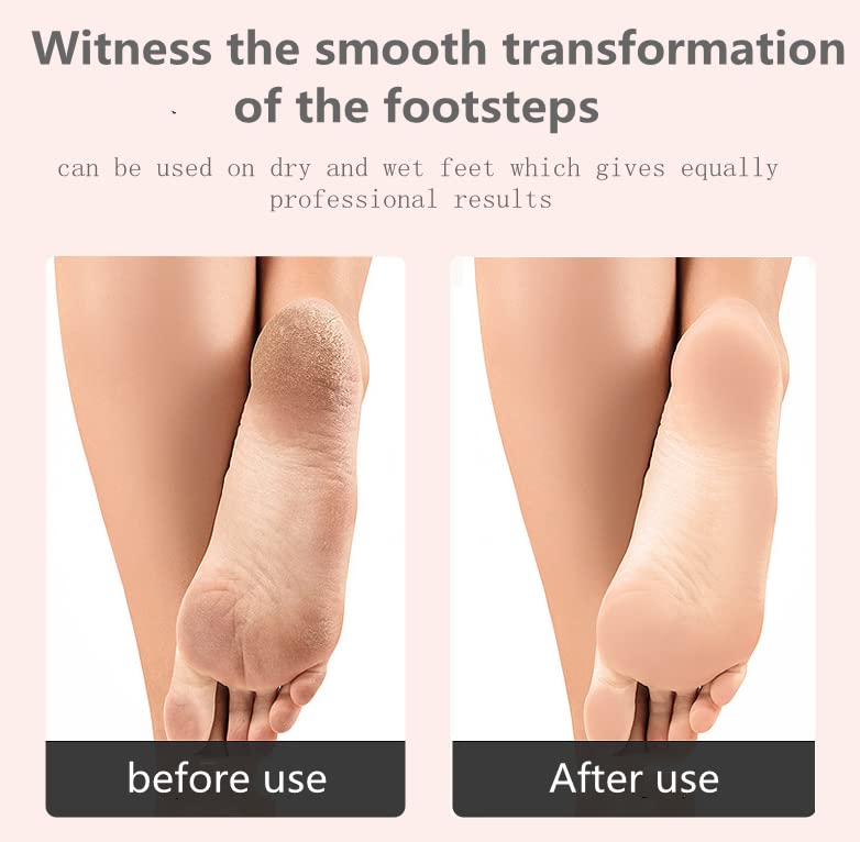 [Australia] - Foot Pumice Brush, Long Handle, Remove Dead Skin Cutin Foot Brush, Scrubbing Pumice Stone, Foot Massage Cleaner 