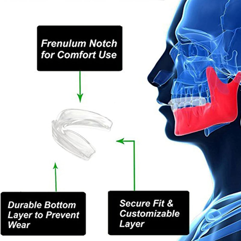 [Australia] - BESPORTBLE Mouth Guard for Teeth Grinding - Teeth Grinding Guard Night Guard Teeth Grinding for Adults Men Women Stops Bruxism 4Pcs 