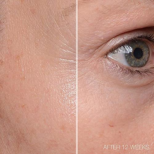 [Australia] - MD Complete Total Eye Treatment | Anti-Aging Hydrating Skin Renewal Eye Treatment | with Peptides, Vitamins C & E and Hyaluronic Acid for Wrinkles, Fine Lines and Crows Feet 