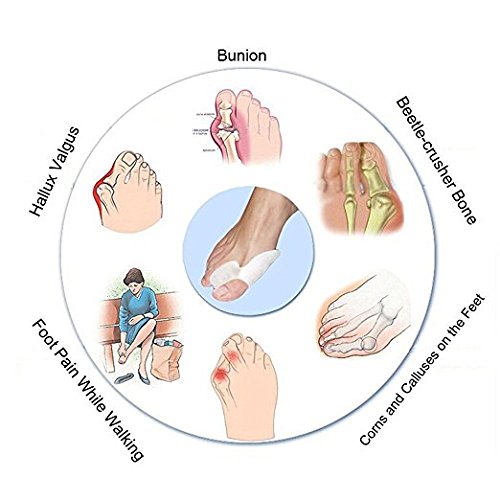[Australia] - Pedimend Silicone Gel Toe Separators - Bunion Protector Cushion (3PAIR) - for Bunion Pain Relief - Big Toe Straighteners - Hallax Valgus Corrector - Unisex - Foot Care 