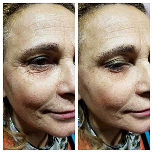 [Australia] - Vitayes Instant Ageback Ageless Facelift Cream for Instant Under Eye Bag Removal, Dark Circles and Fine Lines (7 ml Tube) 