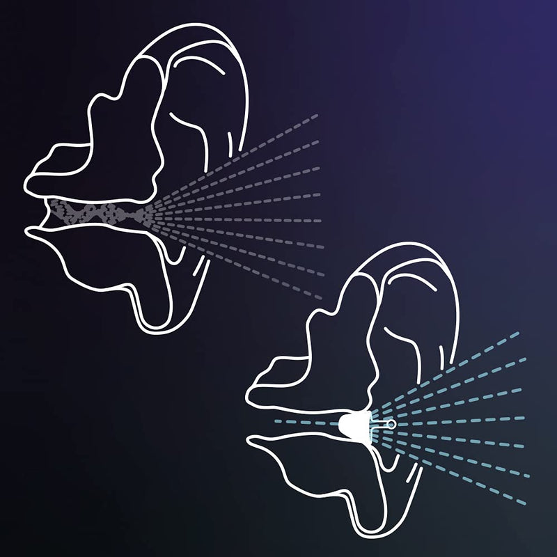 [Australia] - Flare Audio® Calmer® Night Mini Black – in Ear Device to Gently Soothe Sound sensitivities - Reduce Stress in The Evening and Whilst Sleeping 