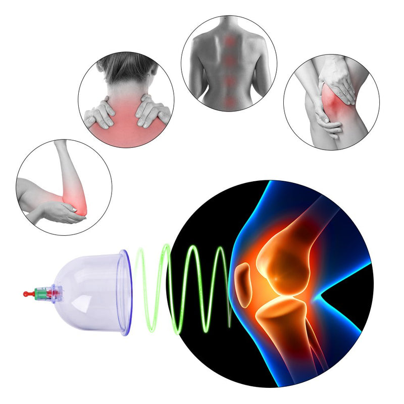 [Australia] - Cupping set, cupping glass set, cupping glasses Professional Chinese cupping therapy set with pump handle and 12 suction cups for the vacuum cupping set 