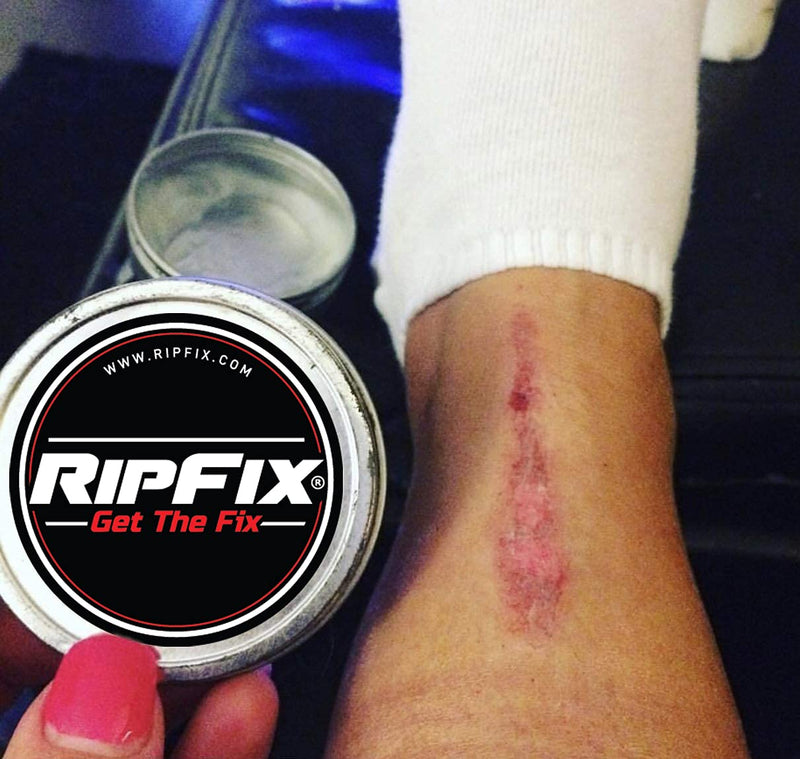 [Australia] - RipFix by Winnies - Hand Repair Cream & Callus Treatment for Cracked or Ripped Hands - 1.34 oz Tin 1.34 Ounce (Pack of 1) 