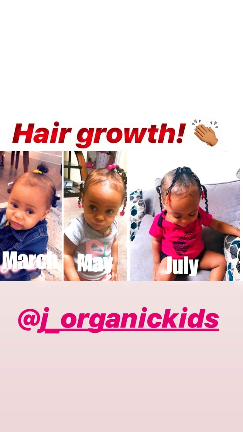 [Australia] - J‚ÄôOrganic Solutions Biotin hair growth Stimulating Conditioner (for kids) with Argan Oil, Aloa Vera & more 