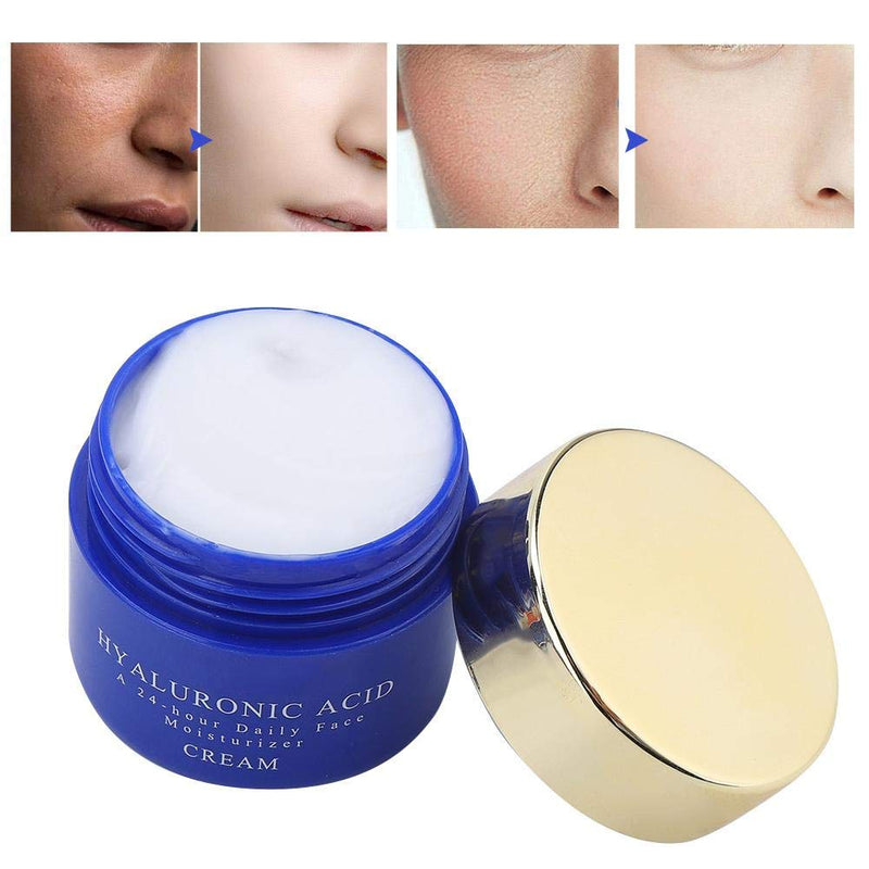 [Australia] - Anti-wrinkle and firming dark circles, fine lines, eye bags，Eye cream to dilute dark circles eye bags anti-wrinkle fine lines men and women fat particles firming moisturizing 