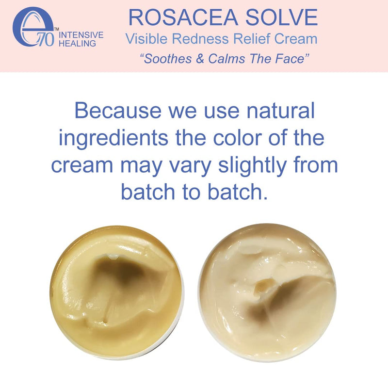 [Australia] - E70 Rosacea Solve - Redness Relief Cream - Calming Face Moisturizer For Rosacea and Acne-Prone Skin - Sensitive Skin Care With Organic Ingredients such as Aloe Vera, Almond Oil, Licorice and Chamomile Extracts - No Parabens 