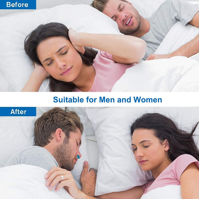 [Australia] - Anti Snoring Device, Anti Snoring Nose Clip Stop Snoring Device Air Purifier, Stop Snoring Best Solution for Ease Breathing Comfortable Sleeping for Men and Women 
