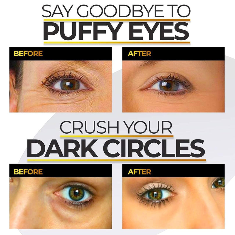 [Australia] - Under Eye Collagen Patches - 24K Gold Eye Mask Anti-Aging Hyaluronic Acid - Under Eye Mask for Reducing Dark Circles & Puffy Eyes (30 Pairs) - Under Eye Bags Treatment 