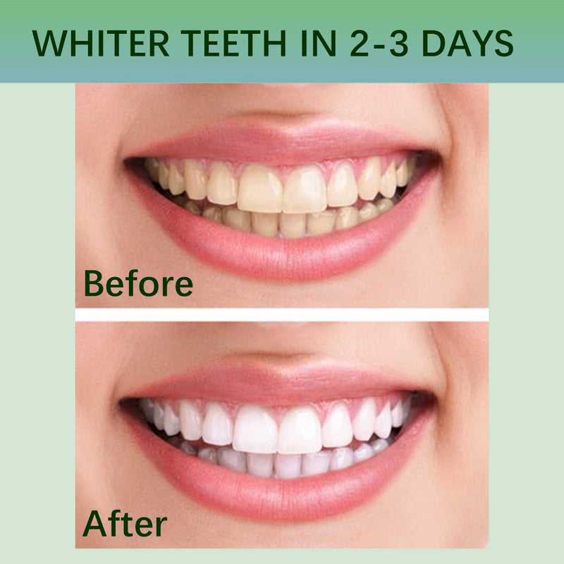 [Australia] - Teeth Whitening Strips, 28 Whitener Strips Effective Teeth Reduced Sensitivity White Strips, Clean Teeth Safely, Stains Remover for Coffee, Wine, Tobacco (14 Treatments) 
