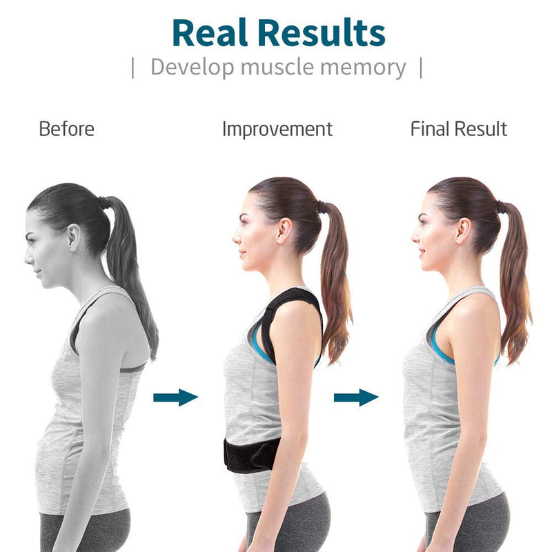 [Australia] - Back Brace Posture Corrector for Women and Men, Back Braces for Upper and Lower Back Pain Relief, Adjustable and Fully Back Support Improve Back Posture and Lumbar Support(L, 35.5"-41.5" Waist) Large (Pack of 1) 