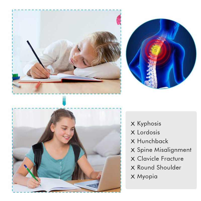 [Australia] - Posture Corrector for Kids, Upper Back Posture Brace for Teenagers Under Clothes Spinal Support to Improve Slouch, Prevent Humpback, Relieve Back Pain Large (Pack of 1) 