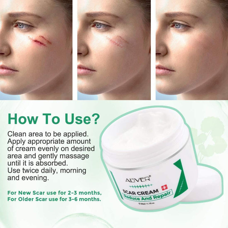 [Australia] - Scar Removal Cream for New Scars, Effective Stretch Mark Removal Natural Skin Repair Prevention of Insect Bites Scars, Face Skin Repair Gel for Men & Women 