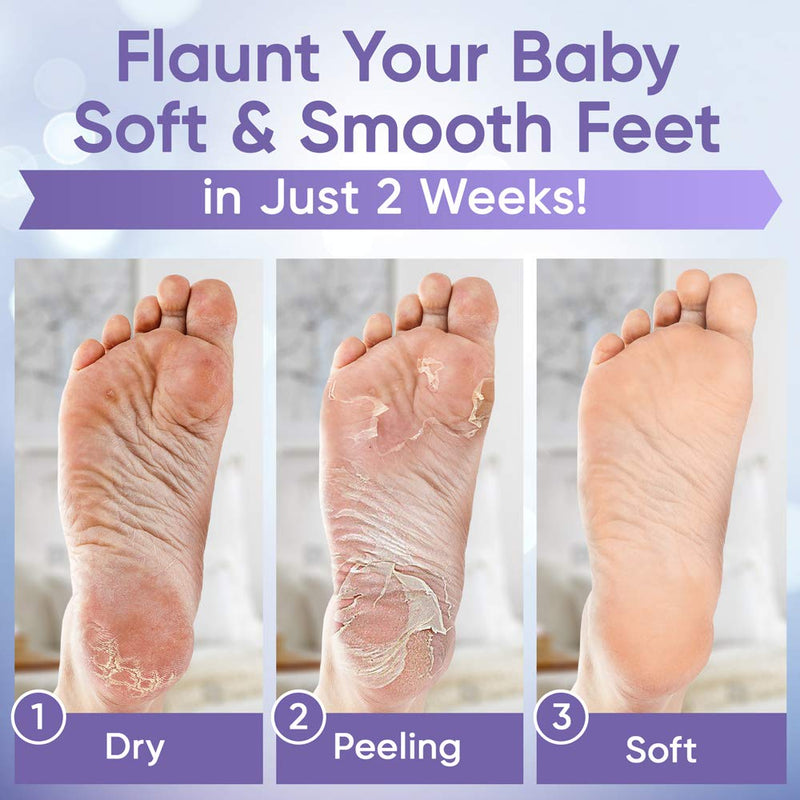 [Australia] - Foot Peel Mask (2 Pairs) - Foot Mask for Baby Feet and Remove Dead Skin - Baby Foot Peel Mask with Lavender and Aloe Vera Gel for Men and Women Feet Peeling Mask 