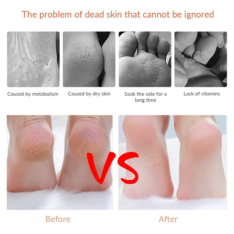 [Australia] - Codream Pedicure Callus Shaver Foot File Care Hard Skin Remover Callus Shaver Sets with Case, Foot File Heads & 10 Replacement Blade 