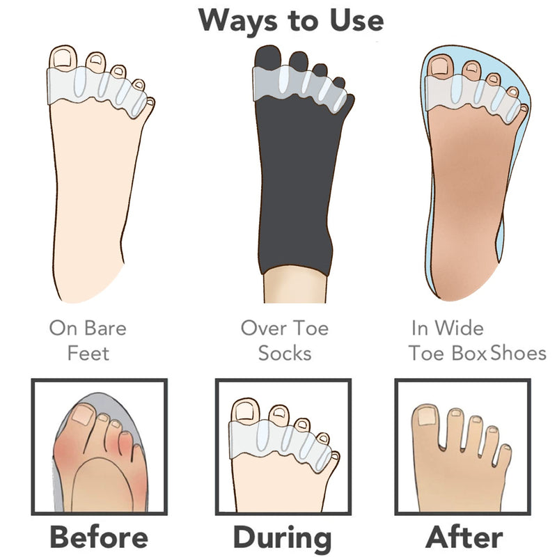 [Australia] - SIQWE 2pcs Toe Separators to Correct Bunions and Restore Toes to Their Original Shape (Bunion Corrector Toe Spacers Toe Straightener Toe Stretcher Big Toe Correctors) 