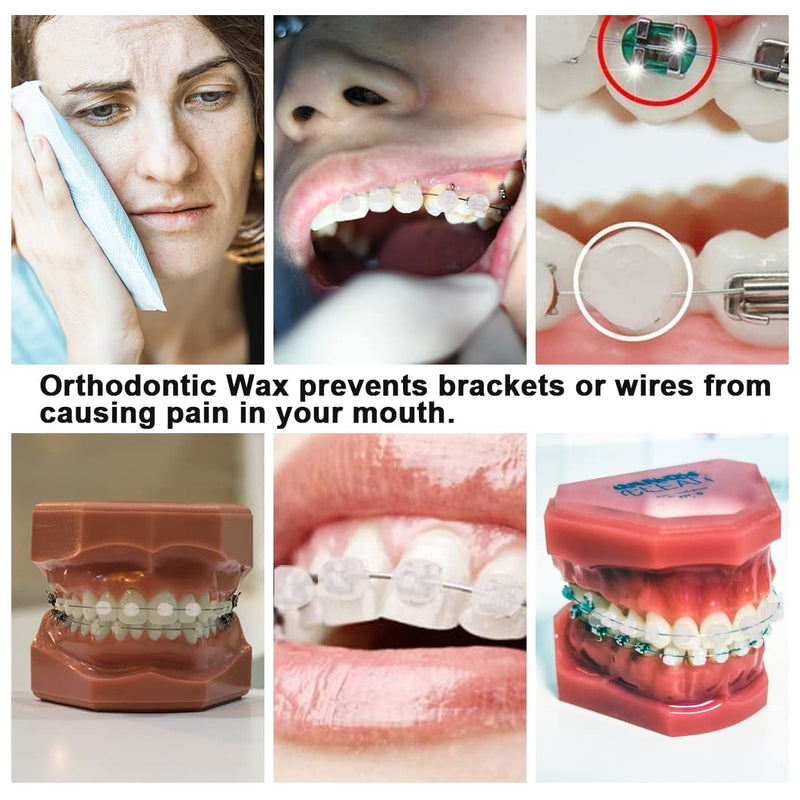 [Australia] - MIBICIRI 6 Boxes Dental Wax for Braces, Dental Cement Orthodontic Care Kits for Braces Protection Pain Relief (Orange Scent) Orange Scent 