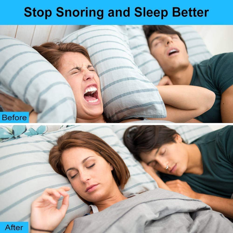 [Australia] - Breathing Relief Nasal Dilator Anti Snore Device - 12 Pack Nose Vents - Simple Snoring Solution for Nose Breathers by JERN (Set of 12) 