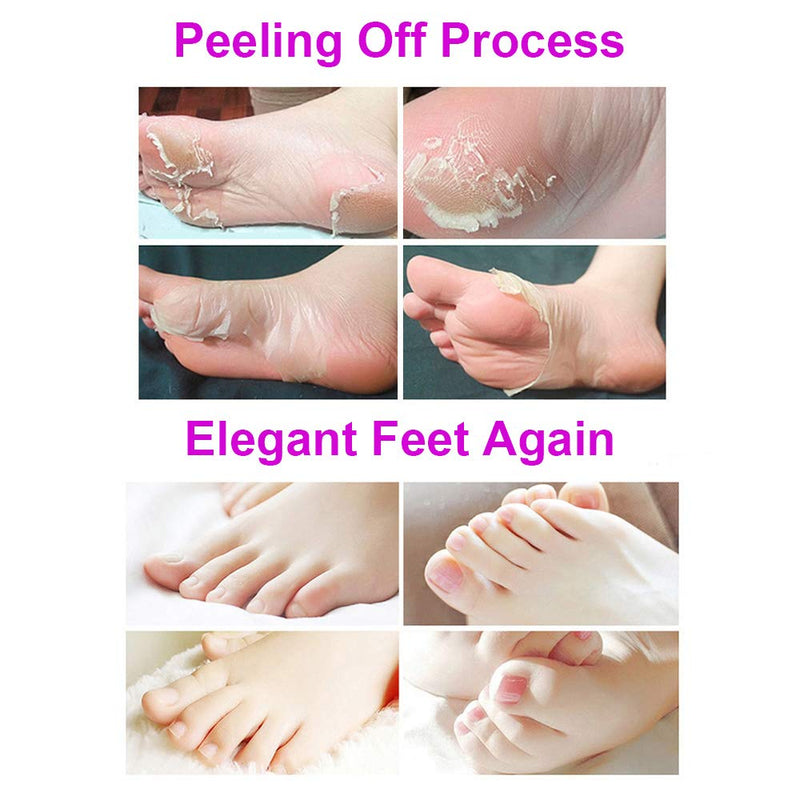 [Australia] - BOMPOW Foot Peel Mask, Exfoliating Socks Foot Mask, Peel Off Dry Dead Cracked Hard Skin in 3-7 Days, Lavender Scented Exfoliating Foot Socks, 2 Pairs Lavender Scent 