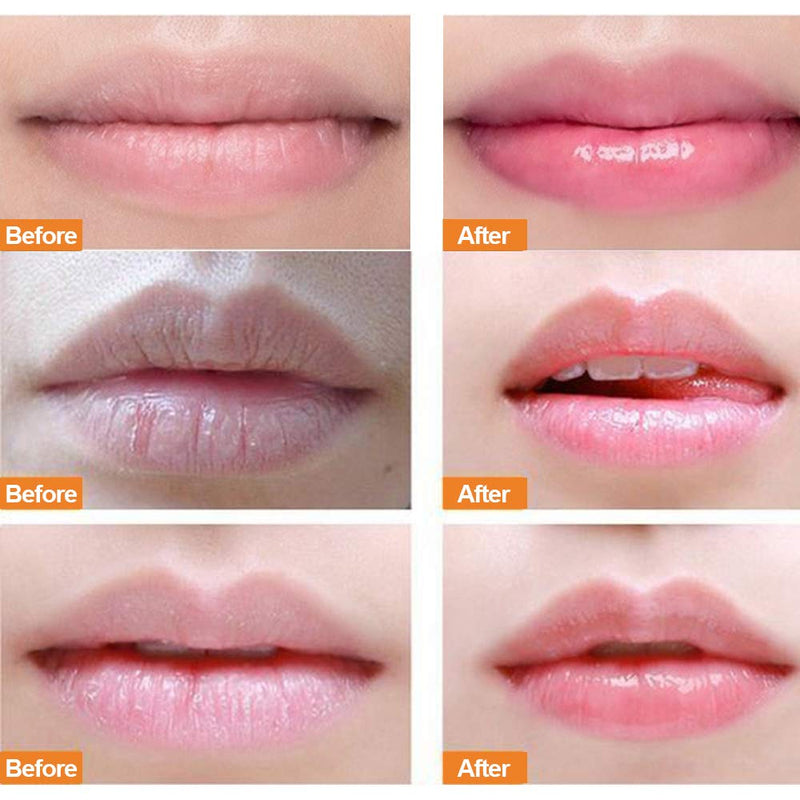 [Australia] - DOUBLE-EFFECT Lip Sleep Mask, Lip Mask+Lip Scrub Intensive, Lip Primer, Lip Sleeping Mask, Lip repair treatment, Lip Repair Balm 1PCS 