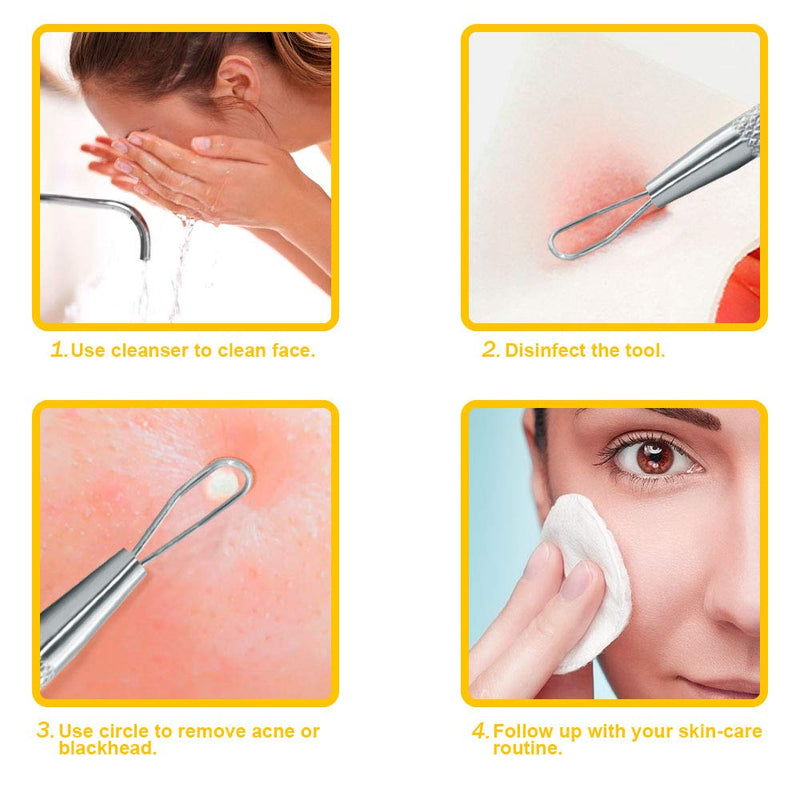 [Australia] - Professional Blackhead Remover Blemish Extractor Tool - Pimple Comedone Removal 2-In-1 Stainless Steel Pimple Popper(2pcs) 