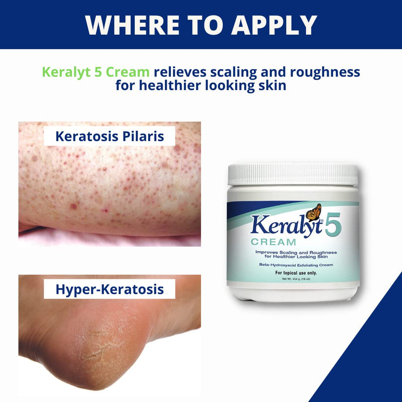 [Australia] - Keralyt 5 Psoriasis Cream - Full Body 5% Salicylic Acid Exfoliating Skin Lotion - Promotes Relief from Itchy, Redness, Dryness, Roughness, and Flakey Skin 5% Cream 