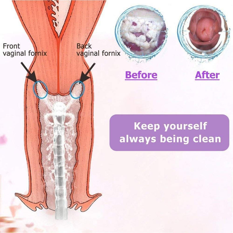 [Australia] - Reusable Vaginal Cleansing System Excellent Vaginal Cleanser Female Vaginal Rinse, Manual Pressure Clean, 100% Safe, 300 ml Capacity Extra 2 Nozzle Tips Doctor Recommended (300ml) 300ml 